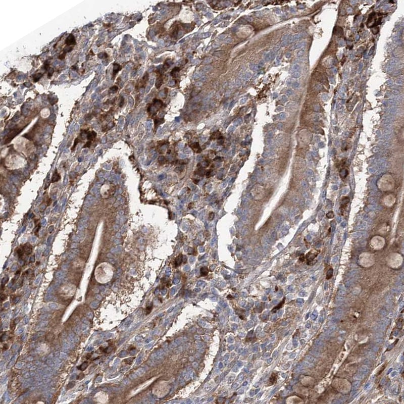 OTUD1 Antibody - BSA Free Immunohistochemistry-Paraffin: OTUD1 Antibody [NBP1-90484]