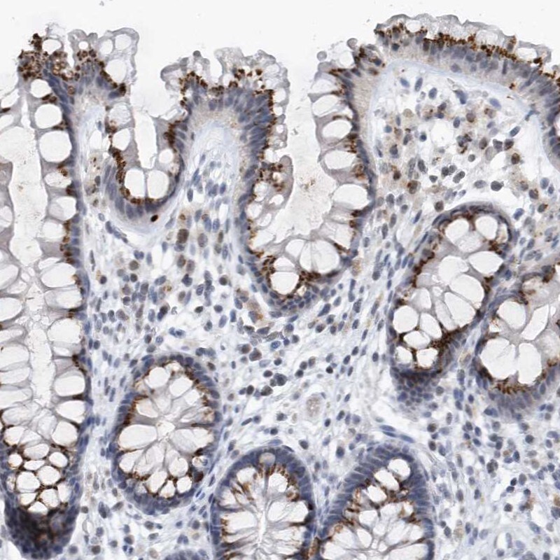 VWA5B2 Antibody - BSA Free Immunohistochemistry: VWA5B2 Antibody - BSA Free [NBP1-90500]