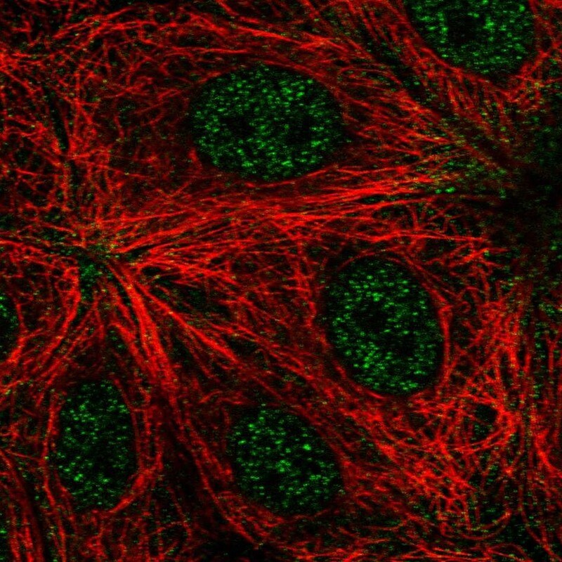 RNF208 Antibody - BSA Free Immunocytochemistry/ Immunofluorescence: RNF208 Antibody [NBP1-90502]