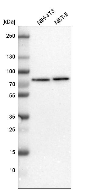 TBC1D15 Antibody - BSA Free Western Blot: TBC1D15 Antibody - BSA Free [NBP1-90503]