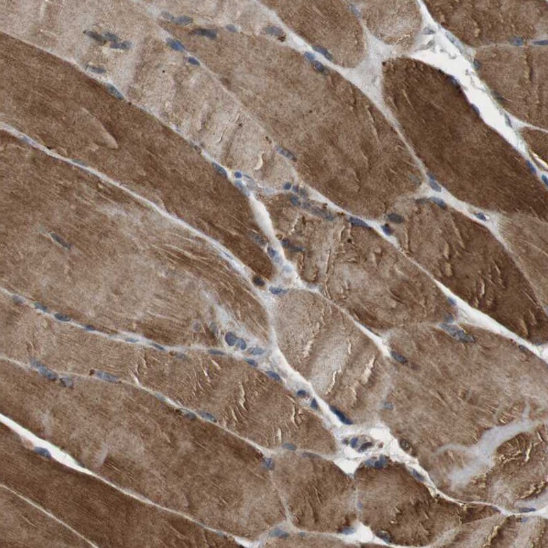TBC1D15 Antibody - BSA Free Immunohistochemistry: TBC1D15 Antibody - BSA Free [NBP1-90504]