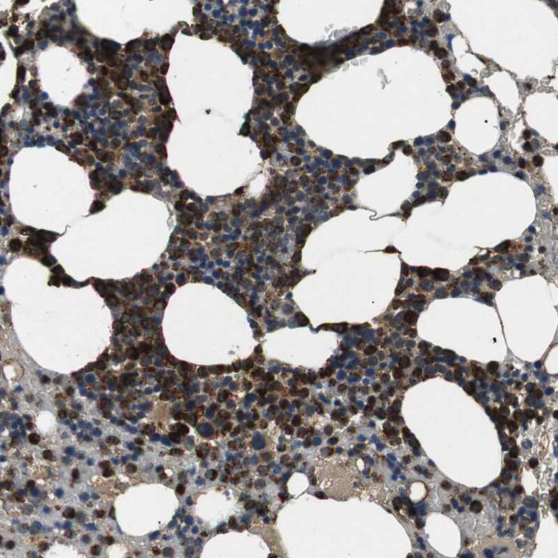 TBC1D15 Antibody - BSA Free Immunohistochemistry: TBC1D15 Antibody - BSA Free [NBP1-90504]