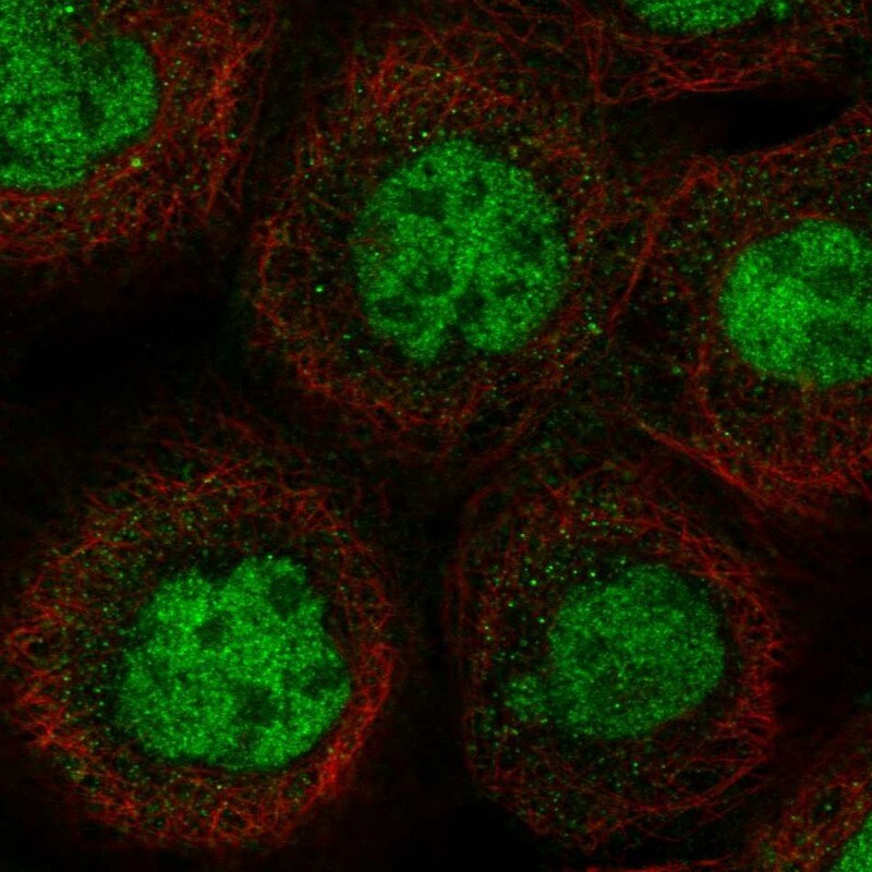 MSL1 Antibody - BSA Free Immunocytochemistry/ Immunofluorescence: MSL1 Antibody [NBP1-90505]