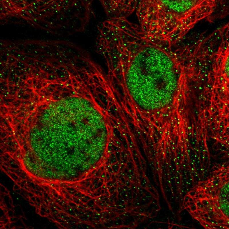 MSL1 Antibody - BSA Free Immunocytochemistry/ Immunofluorescence: MSL1 Antibody [NBP1-90506]