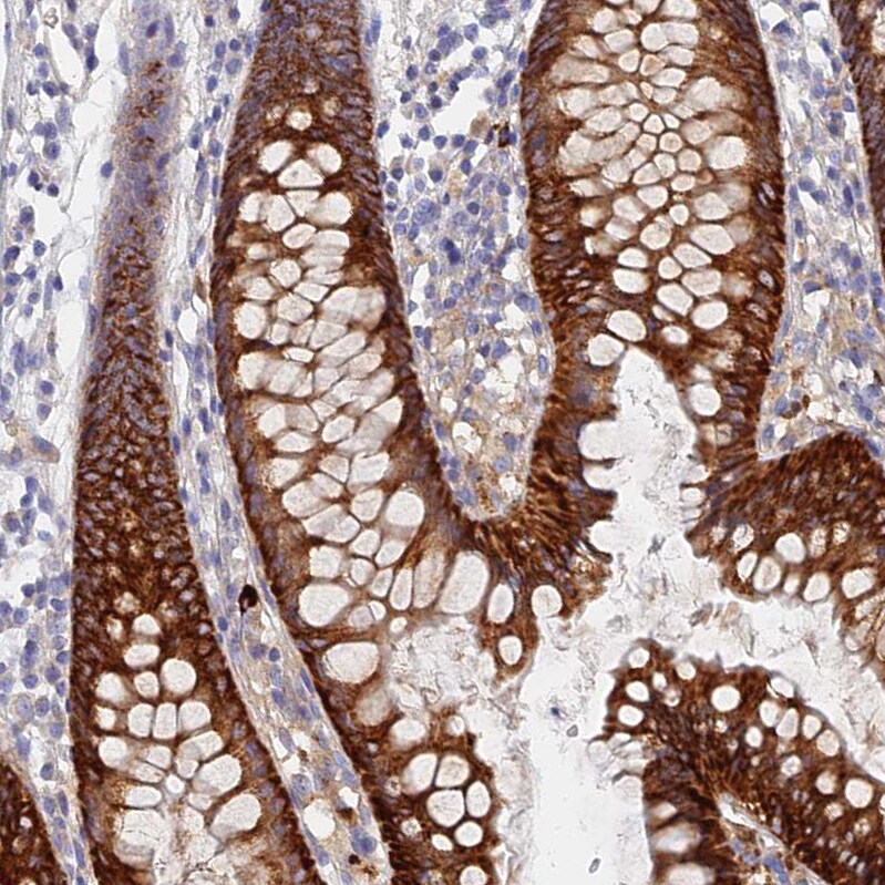 TMEM44 Antibody - BSA Free Immunohistochemistry: TMEM44 Antibody - BSA Free [NBP1-90507]