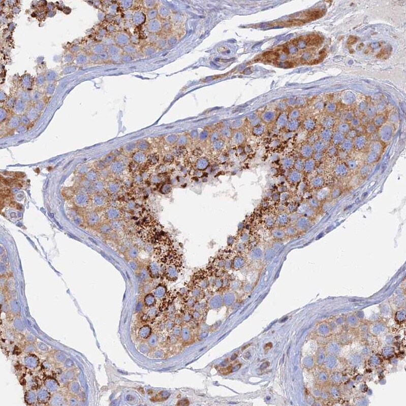 TMEM44 Antibody - BSA Free Immunohistochemistry: TMEM44 Antibody - BSA Free [NBP1-90507]