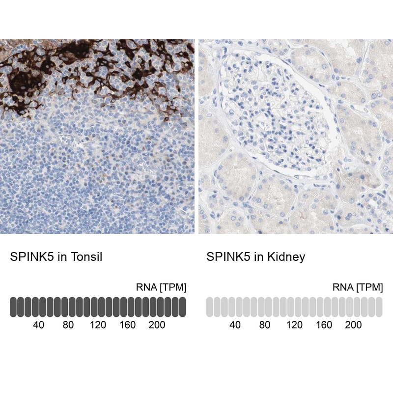 SPINK5 Antibody - BSA Free Immunohistochemistry: SPINK5 Antibody - BSA Free [NBP1-90509]