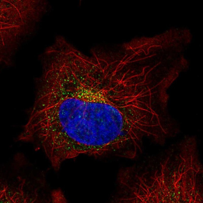 SPINK5 Antibody - BSA Free Immunocytochemistry/ Immunofluorescence: SPINK5 Antibody [NBP1-90510]
