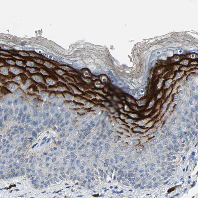 SPINK5 Antibody - BSA Free Immunohistochemistry: SPINK5 Antibody - BSA Free [NBP1-90510]