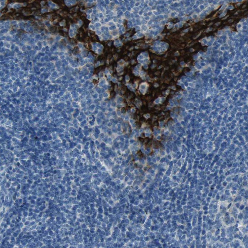 SPINK5 Antibody - BSA Free Immunohistochemistry: SPINK5 Antibody - BSA Free [NBP1-90510]