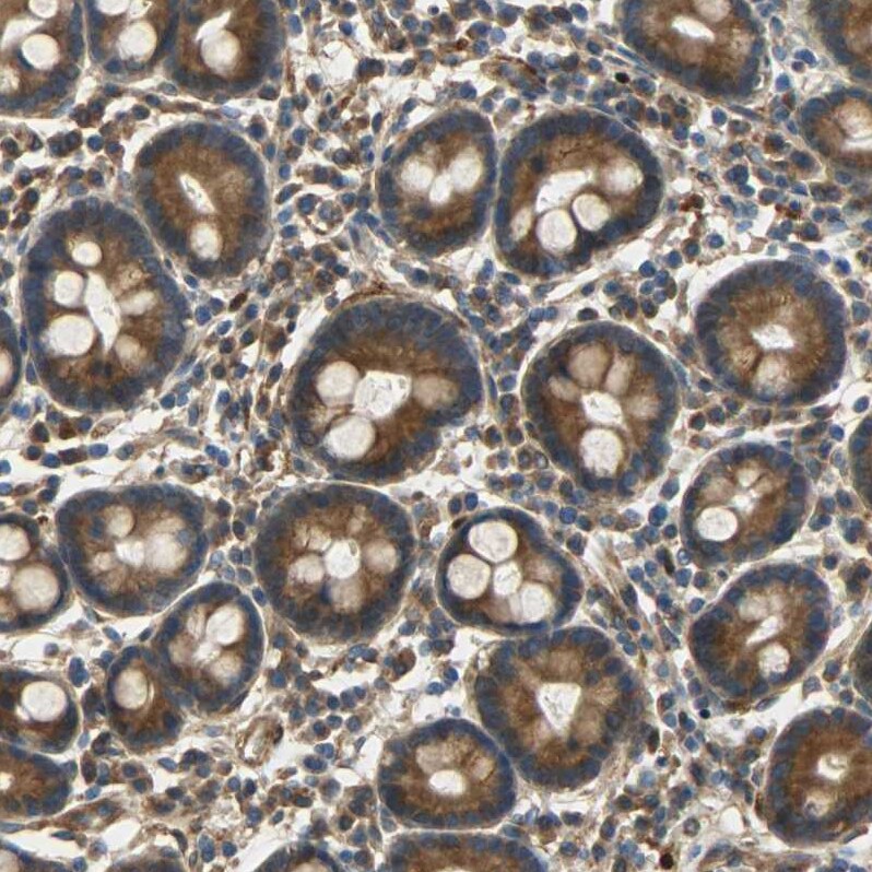 C1orf198 Antibody - BSA Free Immunohistochemistry: C1orf198 Antibody - BSA Free [NBP1-90519]