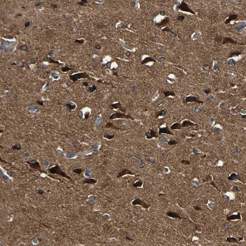 C1orf198 Antibody - BSA Free Immunohistochemistry: C1orf198 Antibody - BSA Free [NBP1-90519]