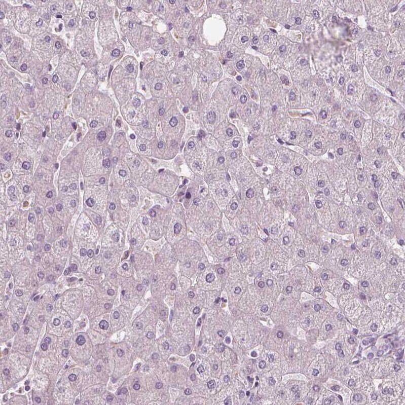 FAM154B Antibody - BSA Free Immunohistochemistry-Paraffin: FAM154B Antibody [NBP1-90520]