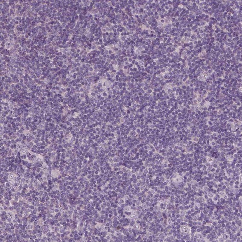 FAM154B Antibody - BSA Free Immunohistochemistry-Paraffin: FAM154B Antibody [NBP1-90520]