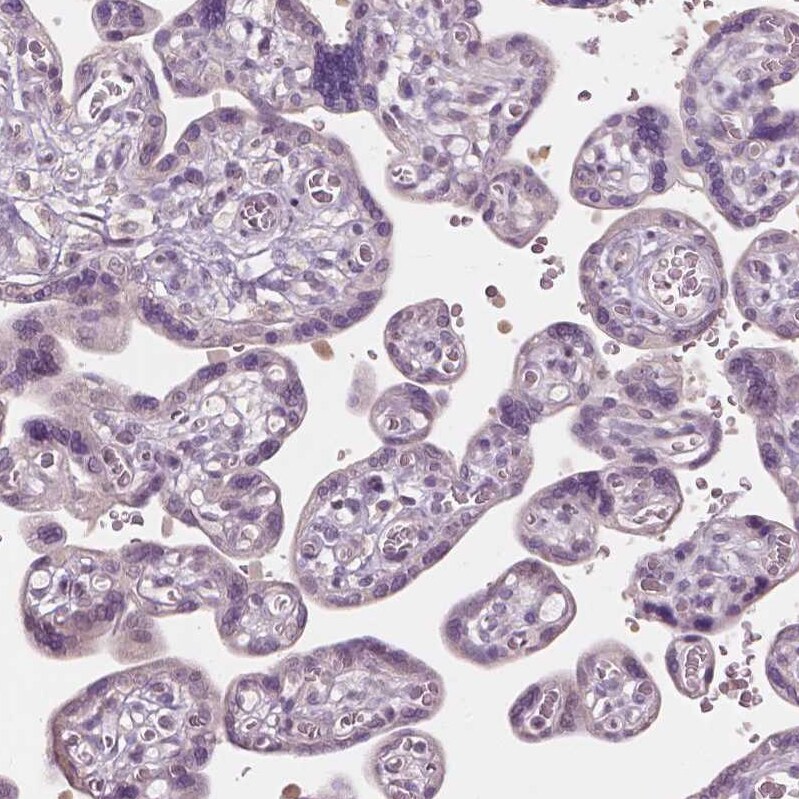 FAM154B Antibody - BSA Free Immunohistochemistry-Paraffin: FAM154B Antibody [NBP1-90520]