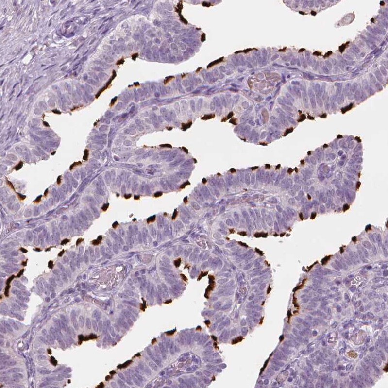 FAM154B Antibody - BSA Free Immunohistochemistry-Paraffin: FAM154B Antibody [NBP1-90520]