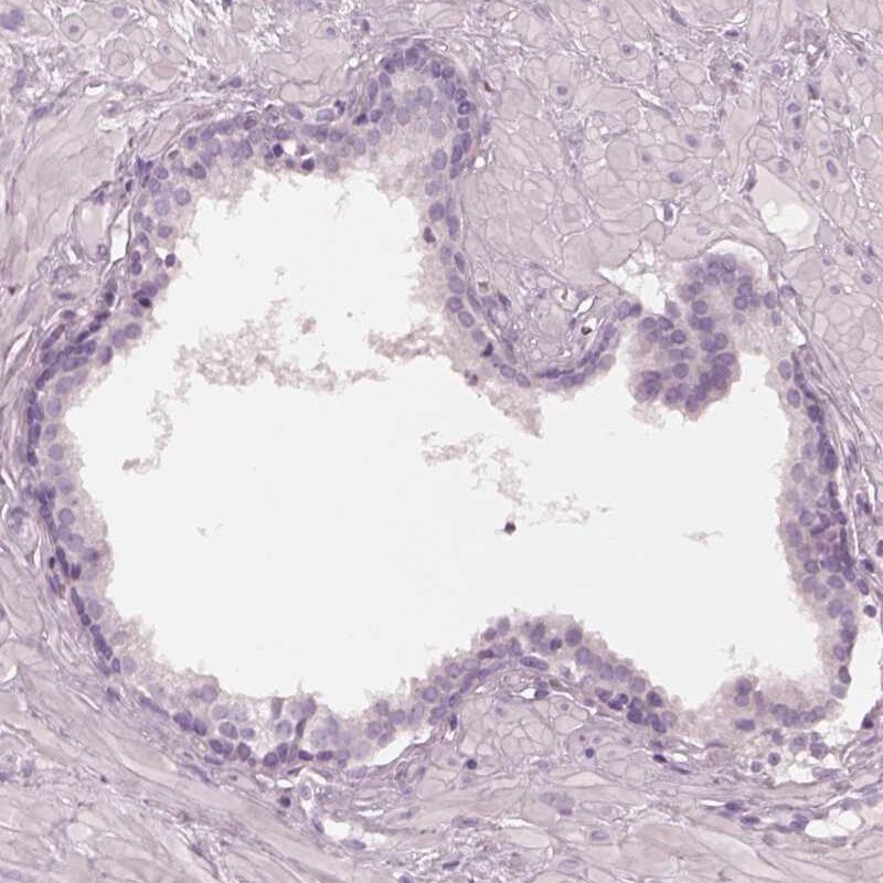 FAM154B Antibody - BSA Free Immunohistochemistry: FAM154B Antibody - BSA Free [NBP1-90521]