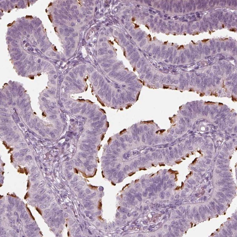 FAM154B Antibody - BSA Free Immunohistochemistry: FAM154B Antibody - BSA Free [NBP1-90521]