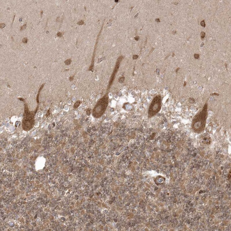 EPC2 Antibody - BSA Free Immunohistochemistry: EPC2 Antibody - BSA Free [NBP1-90523]