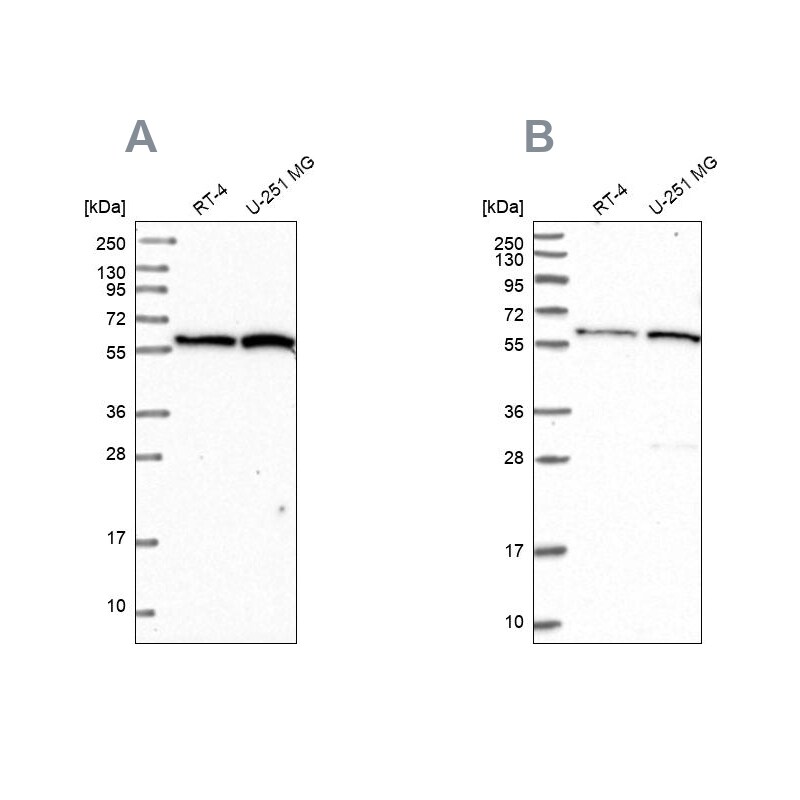 VWA9 Antibody - BSA Free Western Blot: VWA9 Antibody - BSA Free [NBP1-90524]