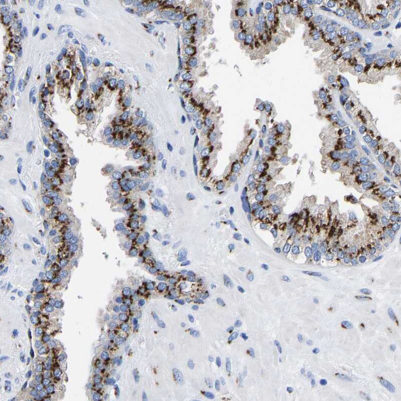 TMEM87A Antibody - BSA Free Immunohistochemistry: TMEM87A Antibody - BSA Free [NBP1-90531]