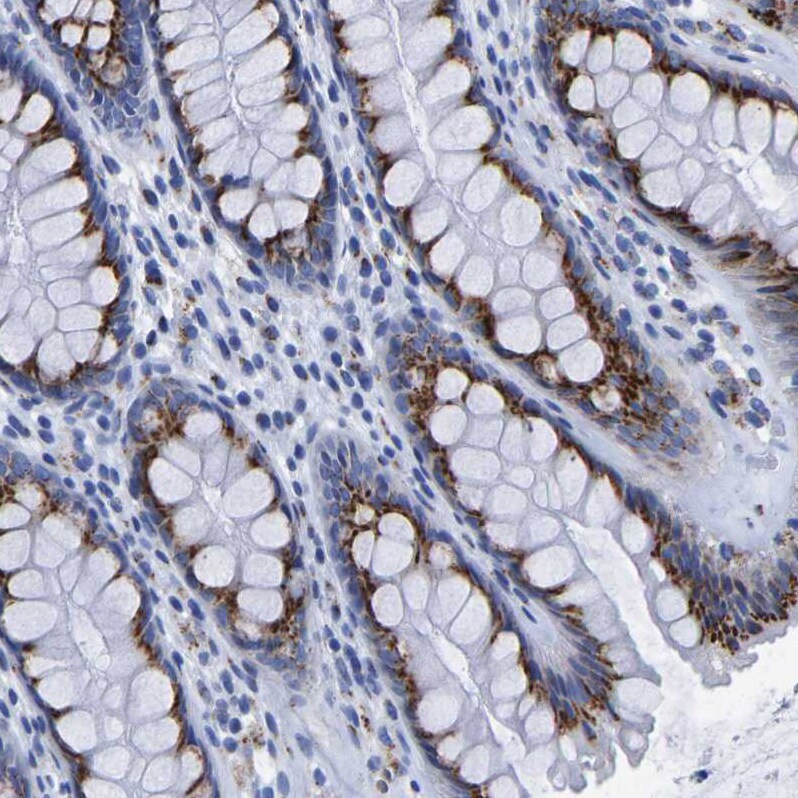 TMEM87A Antibody - BSA Free Immunohistochemistry: TMEM87A Antibody - BSA Free [NBP1-90531]