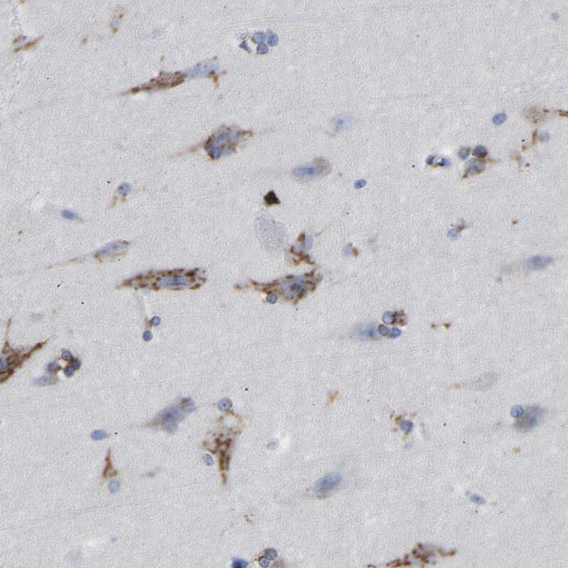 TMEM87A Antibody - BSA Free Immunohistochemistry: TMEM87A Antibody - BSA Free [NBP1-90532]