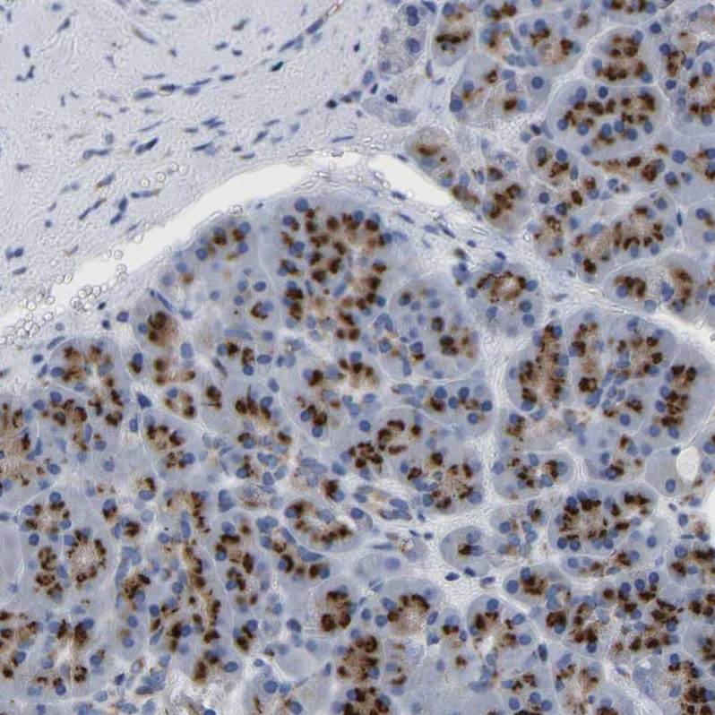 TMEM87A Antibody - BSA Free Immunohistochemistry: TMEM87A Antibody - BSA Free [NBP1-90532]