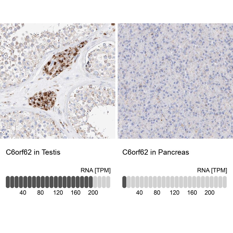 XTP12 Antibody - BSA Free Immunohistochemistry: XTP12 Antibody - BSA Free [NBP1-90534]