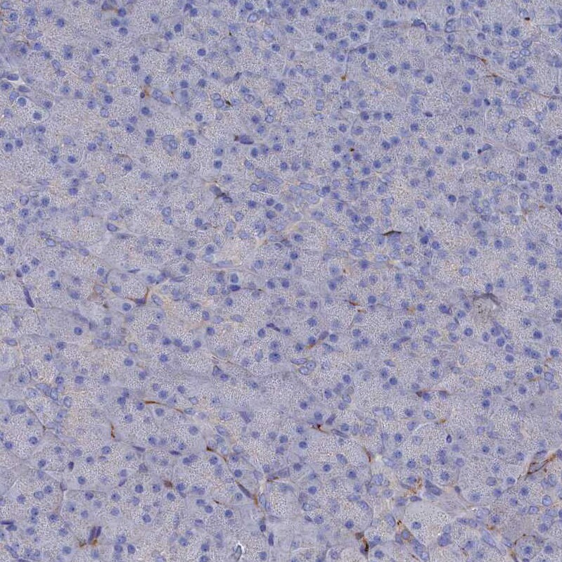 C12orf73 Antibody - BSA Free Immunohistochemistry: C12orf73 Antibody - BSA Free [NBP1-90536]