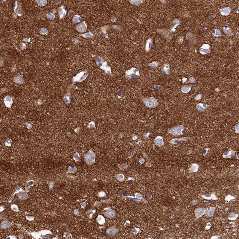 C12orf73 Antibody - BSA Free Immunohistochemistry: C12orf73 Antibody - BSA Free [NBP1-90536]