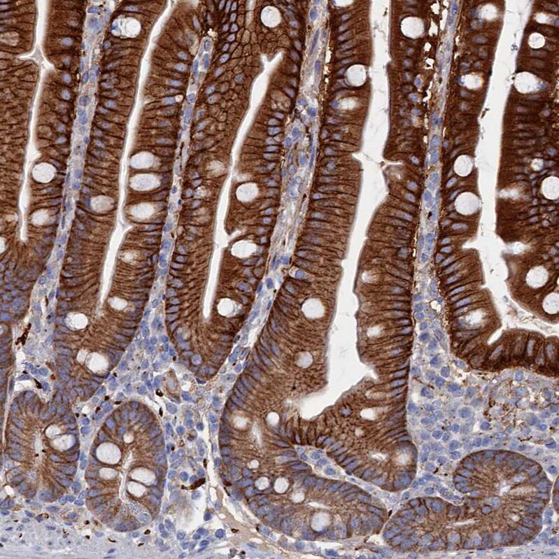 C12orf73 Antibody - BSA Free Immunohistochemistry: C12orf73 Antibody - BSA Free [NBP1-90536]