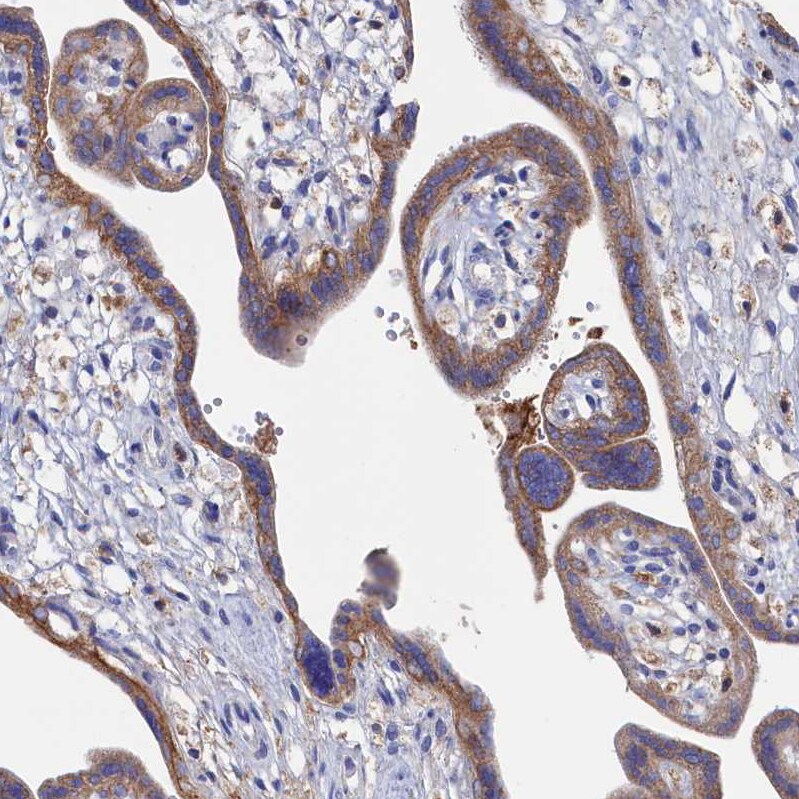 C12orf73 Antibody - BSA Free Immunohistochemistry: C12orf73 Antibody - BSA Free [NBP1-90536]