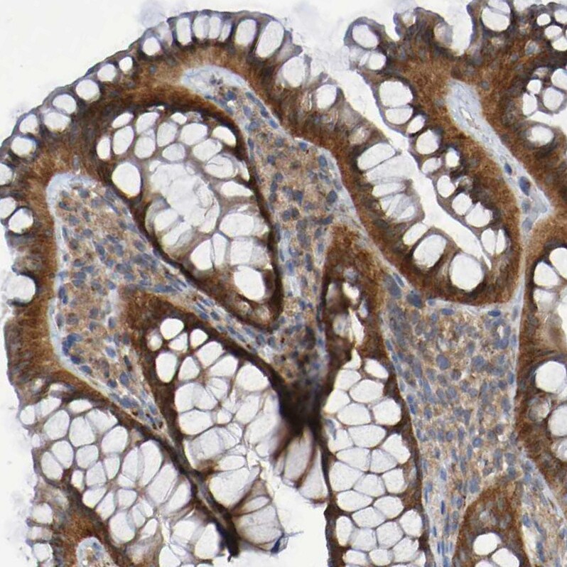 LMBRD2 Antibody - BSA Free Immunohistochemistry: LMBRD2 Antibody - BSA Free [NBP1-90551]