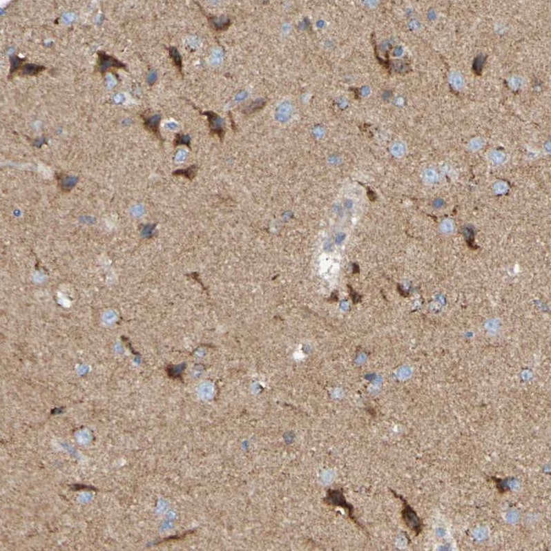 LMBRD2 Antibody - BSA Free Immunohistochemistry: LMBRD2 Antibody - BSA Free [NBP1-90551]