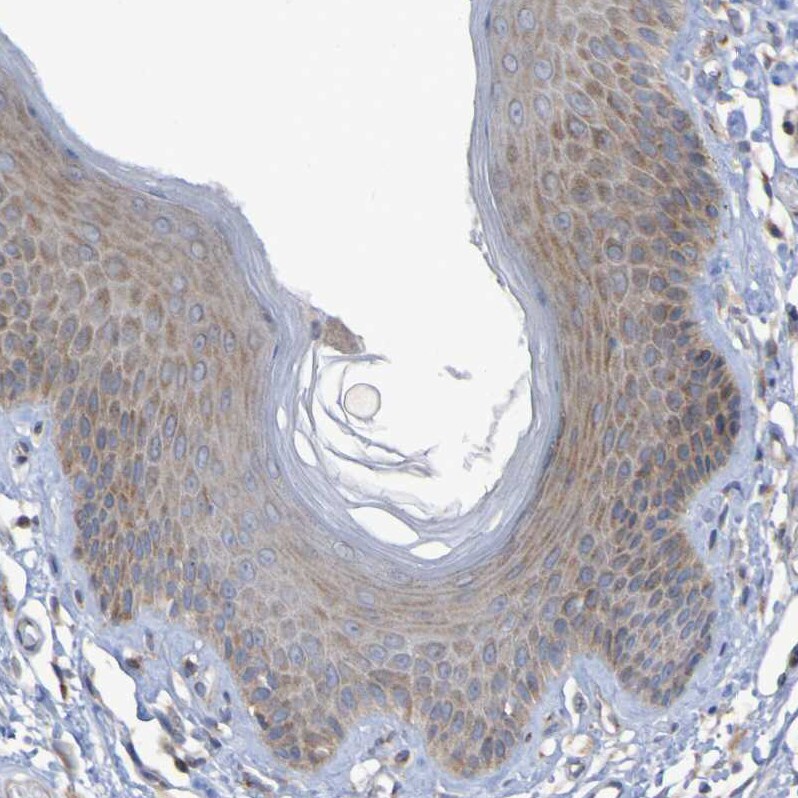 LMBRD2 Antibody - BSA Free Immunohistochemistry: LMBRD2 Antibody - BSA Free [NBP1-90551]