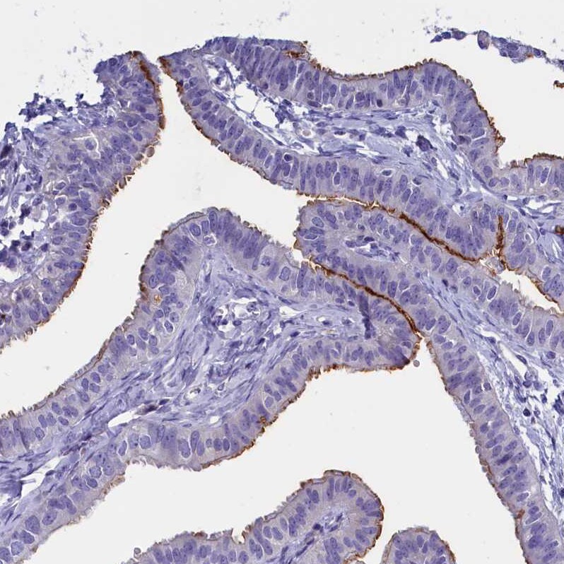 rotatin Antibody - BSA Free Immunohistochemistry: rotatin Antibody - BSA Free [NBP1-90555]