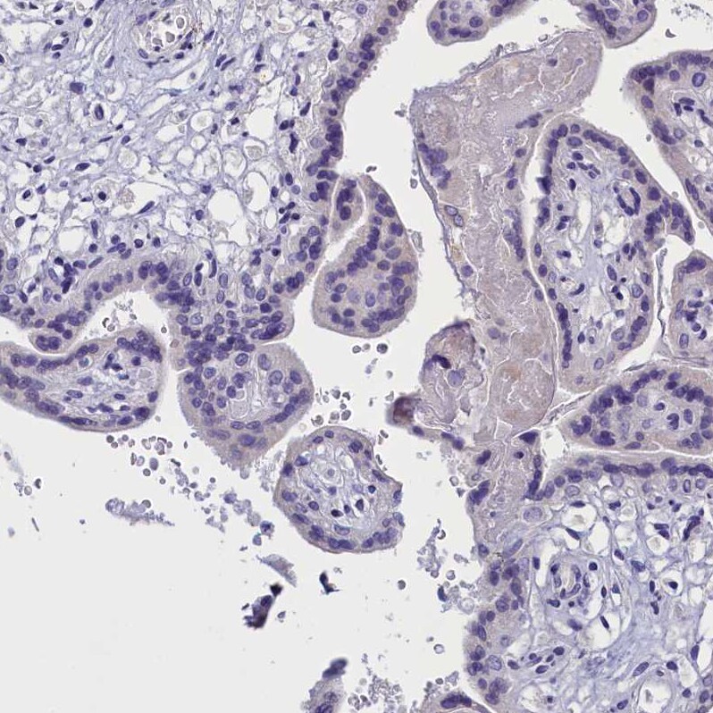 rotatin Antibody - BSA Free Immunohistochemistry: rotatin Antibody - BSA Free [NBP1-90555]