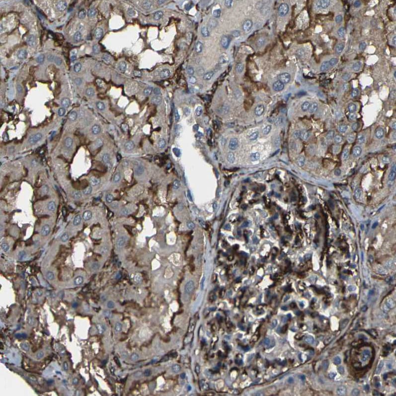 GRAMD1C Antibody - BSA Free Immunohistochemistry: GRAMD1C Antibody - BSA Free [NBP1-90559]