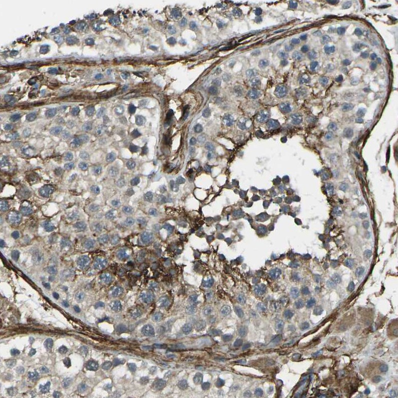 GRAMD1C Antibody - BSA Free Immunohistochemistry: GRAMD1C Antibody - BSA Free [NBP1-90559]