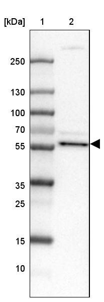 CNBD2 Antibody - BSA Free Western Blot: CNBD2 Antibody - BSA Free [NBP1-90562]