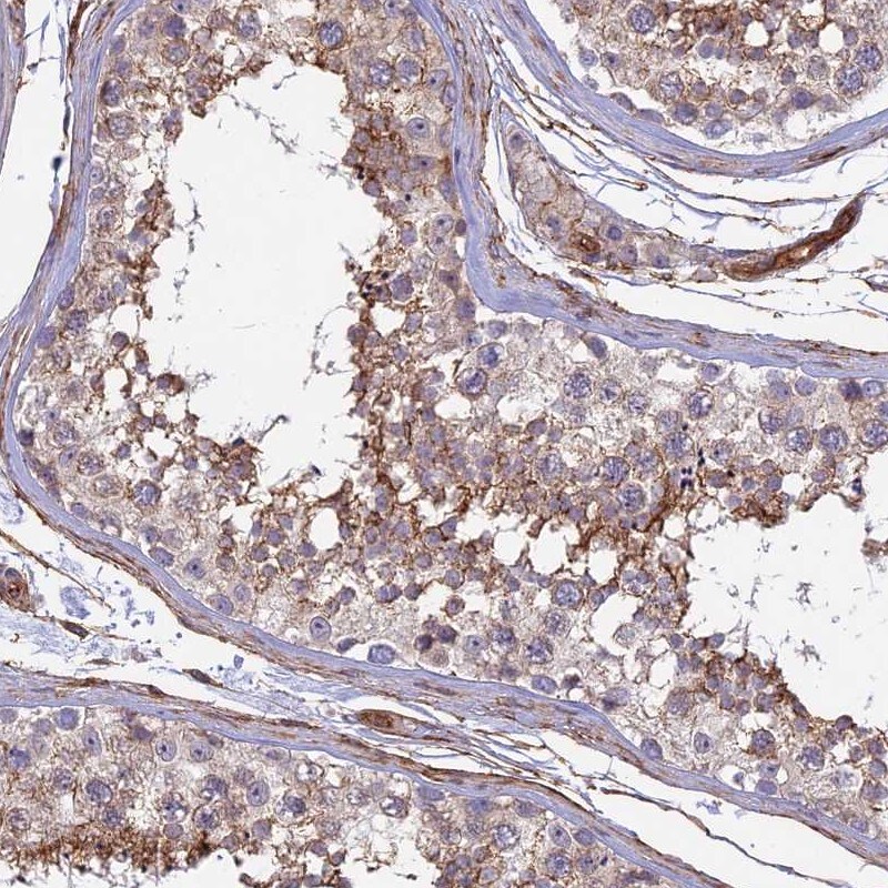 CNBD2 Antibody - BSA Free Immunohistochemistry: CNBD2 Antibody - BSA Free [NBP1-90562]