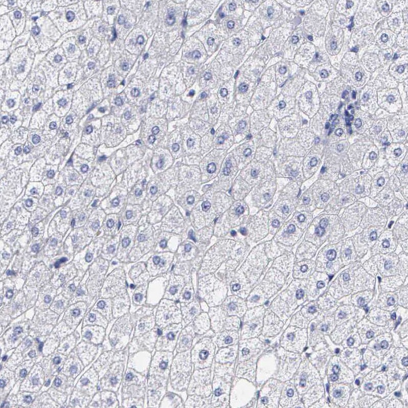 ELFN2 Antibody - BSA Free Immunohistochemistry: ELFN2 Antibody - BSA Free [NBP1-90569]