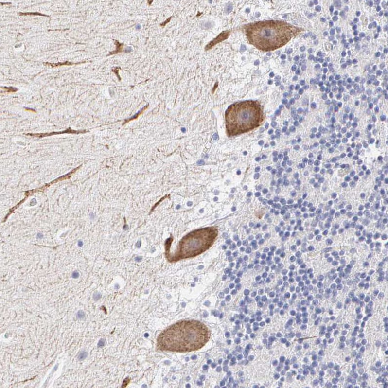 ELFN2 Antibody - BSA Free Immunohistochemistry: ELFN2 Antibody - BSA Free [NBP1-90569]
