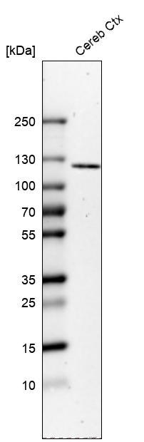 ELFN2 Antibody - BSA Free Western Blot: ELFN2 Antibody - BSA Free [NBP1-90569]