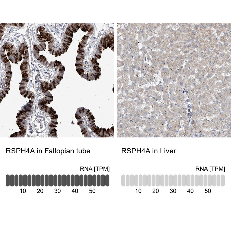 RSPH4A Antibody - BSA Free Immunohistochemistry-Paraffin: RSPH4A Antibody [NBP1-90572]