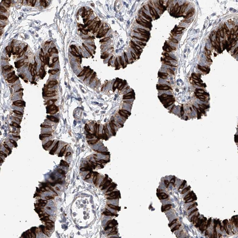 RSPH4A Antibody - BSA Free Immunohistochemistry-Paraffin: RSPH4A Antibody [NBP1-90572]