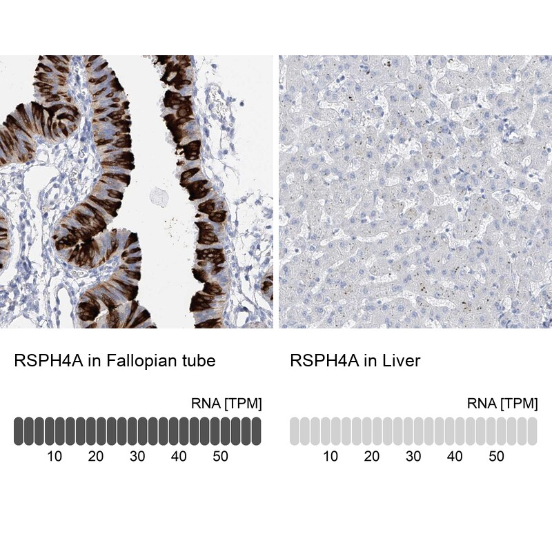 RSPH4A Antibody - BSA Free Immunohistochemistry: RSPH4A Antibody - BSA Free [NBP1-90574]