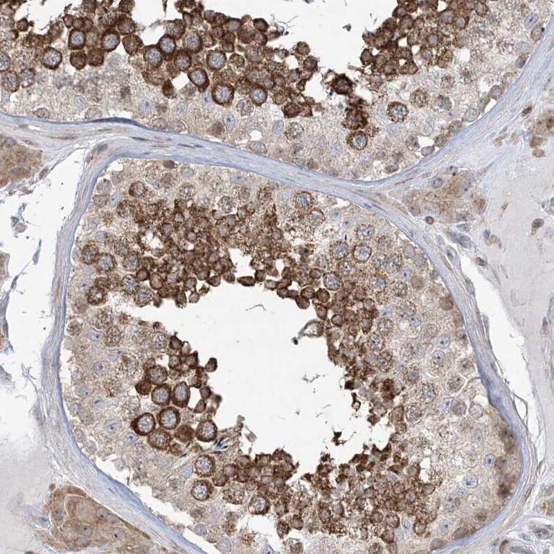 SOGA3 Antibody - BSA Free Immunohistochemistry-Paraffin: SOGA3 Antibody [NBP1-90575]