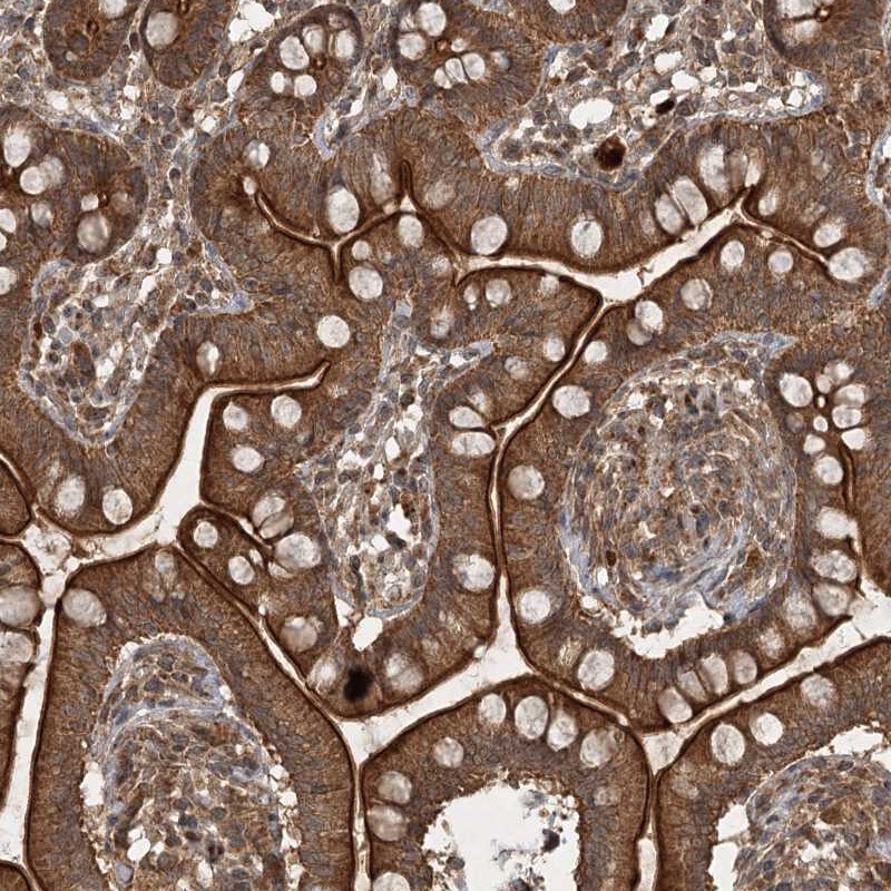UNC93A Antibody - BSA Free Immunohistochemistry-Paraffin: UNC93A Antibody [NBP1-90576]